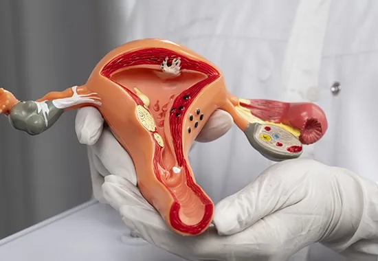 causes relachement vaginal img 3