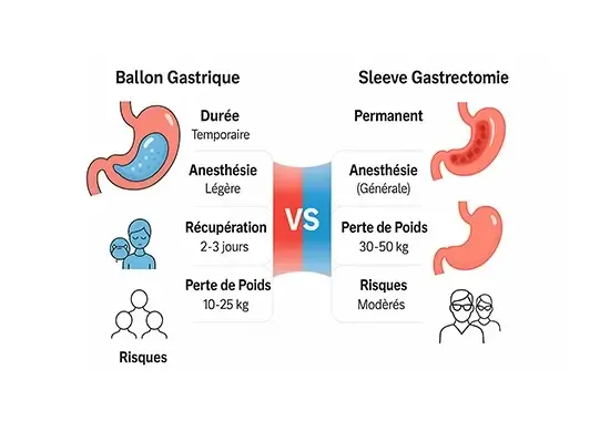 comparaison ballon gastrique et sleeve gastrique img 4
