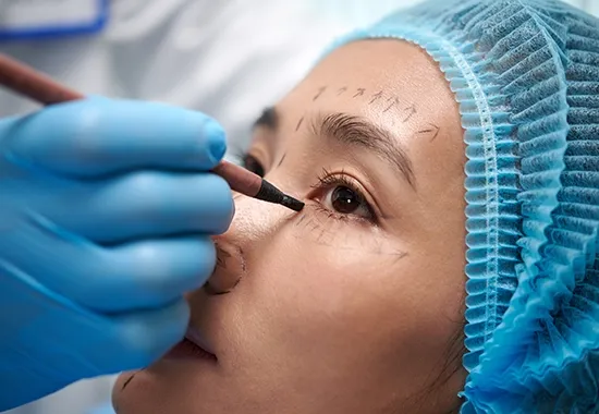 deroulement blepharoplastie tunisie img 5