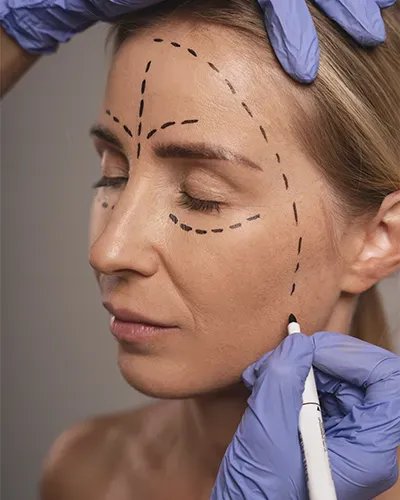 lifting visage 2400 euros