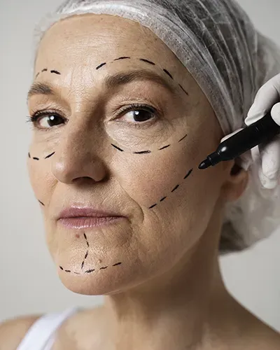 lipofilling visage 2100 euros