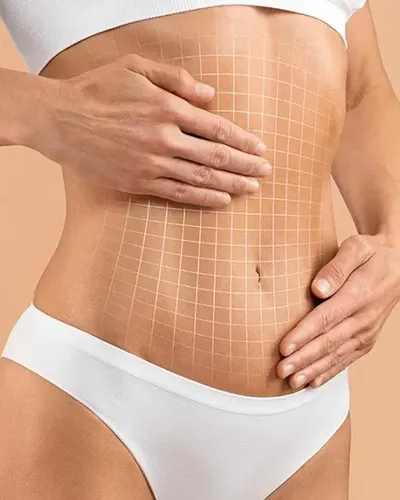 liposuccion abdominoplastie