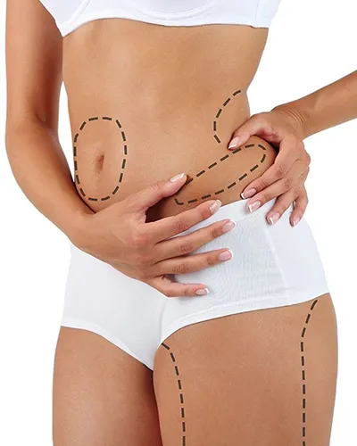 liposuccion complete
