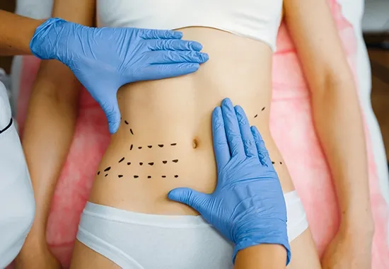 power assisted liposuction img 3