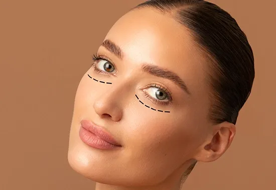 resultat blepharoplastie tunisie img 6