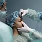rhinoplastie tunisie
