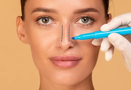 rhinoplastie tunisie img 2
